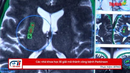 Các nhà khoa học Bỉ giải mã thành công bệnh Parkinson