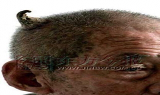 Thế giới những người mọc sừng