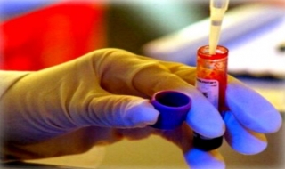 5 trường hợp thực hiện xét nghiệm HIV bắt buộc