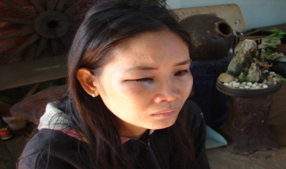 Chồng nát rượu hành hung vợ gây thương tích
