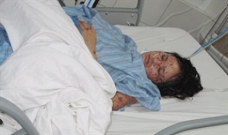 Dịch viêm não mô cầu đã xuất hiện ở 5 tỉnh thành