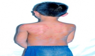 Cần nghiêm trị kẻ hành hung trẻ em