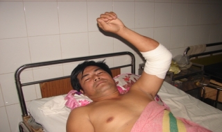 Nổi máu ghen, thuê côn đồ chém người