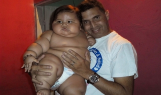 Bé 8 tháng tuổi nặng 20 kg