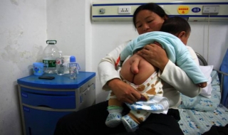 Bé 5 tháng tuổi có 'đuôi' dài 13 cm