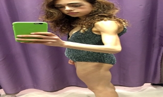 Bị chê 'đùi to' vũ công balê xinh đẹp giảm xuống chỉ còn 25kg
