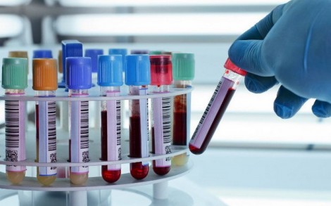 Cách đọc kết quả xét nghiệm máu, ý nghĩa các chỉ số xét nghiệm máu