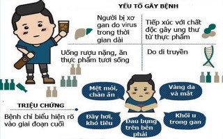 Dấu hiệu nhận biết và tránh ung thư gan