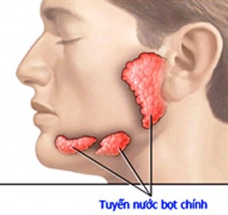 Xuất hiện dấu hiệu này bạn nên nghĩ đến ung thư tuyến nước bọt