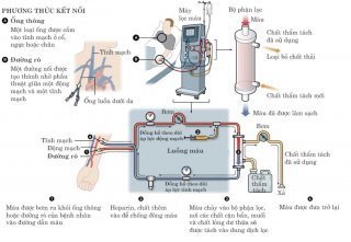 [Infographics] Quy trình chạy thận nhân tạo cần tuân thủ chặt chẽ