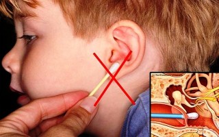 Tác hại của việc thích ngoáy tai