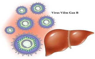 Viêm gan siêu vi B là bệnh nguy hiểm