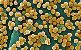 Khuẩn tụ cầu vàng - nguyên nhân số 1 gây ngộ độc thực phẩm ở TP HCM