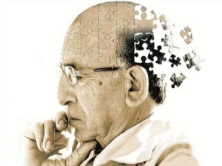 Dấu hiệu bệnh Alzheimer