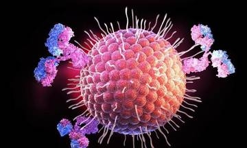 Cụ ông bị viêm não do virus Herpes