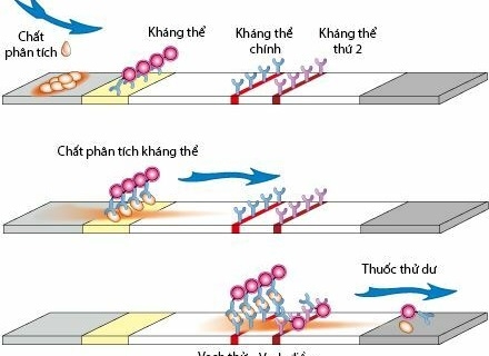 Que test HIV bị cắt sẽ làm sai lệch kết quả xét nghiệm