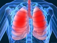Giám sát chặt chẽ bệnh viêm phổi cấp tại cửa khẩu