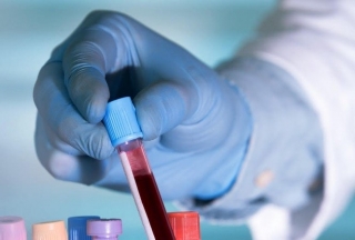Nghiên cứu mới: Người có nhóm máu A dễ mắc Covid-19