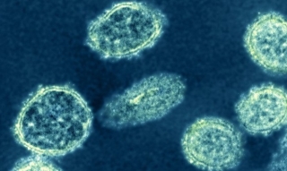 Chuyên gia cảnh báo nguy cơ đại dịch do chủng mới virus H1N1 ở TQ
