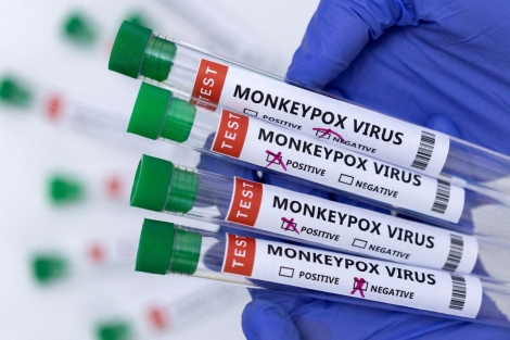 Hơn 20 quốc gia xuất hiện bệnh đậu mùa khỉ, TPHCM lên kịch bản ứng phó