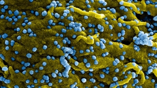 Chuyên gia nói gì về khả năng lây lan virus Marburg nguy hiểm?