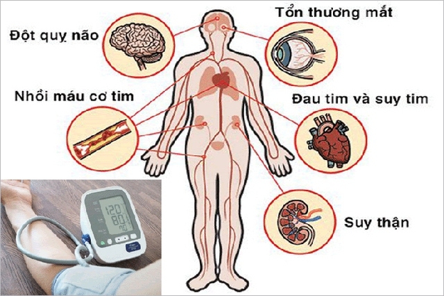 Những thực phẩm tự nhiên giúp hạ huyết áp an toàn