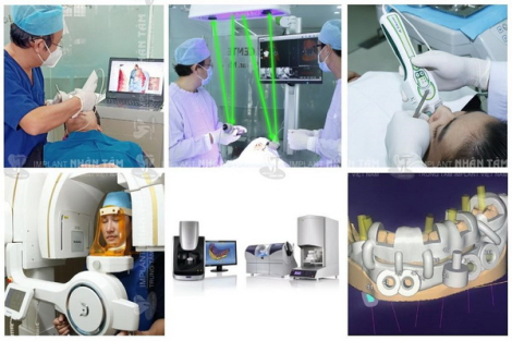 Implant Việt Nam - Trung tâm chuyên sâu trồng răng Implant tiêu chuẩn quốc tế