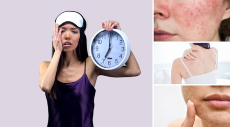 Ngủ đủ giấc giúp phục hồi và tái tạo da như thế nào?