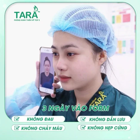Nâng mũi siêu vi phẫu tại Tara Clinic an toàn và hoàn hảo